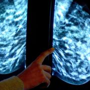 A new study has enabled scientists to study breast tissue in detail outside the body (Rui Vieira/PA)