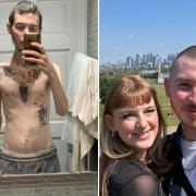 Liam Sylvester - Left: During his illness. Right: Following full recovery.